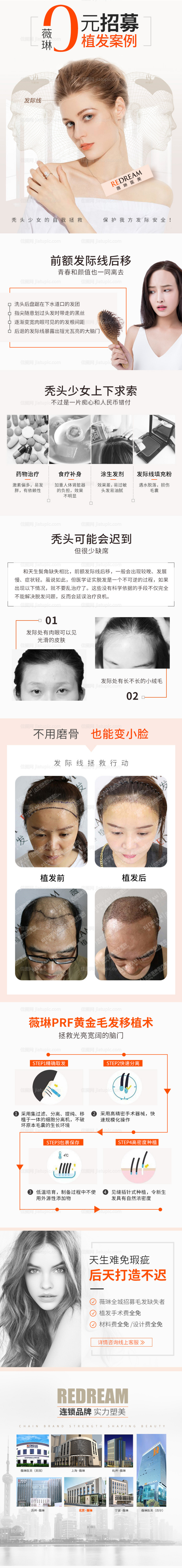 植发详情案例招募详情页-源文件
