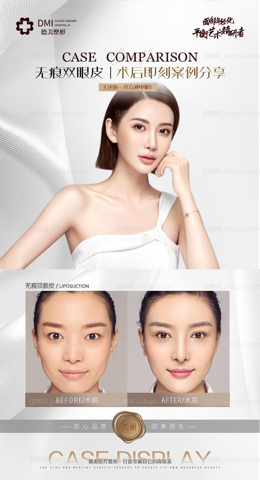 医美案例对比海报-源文件