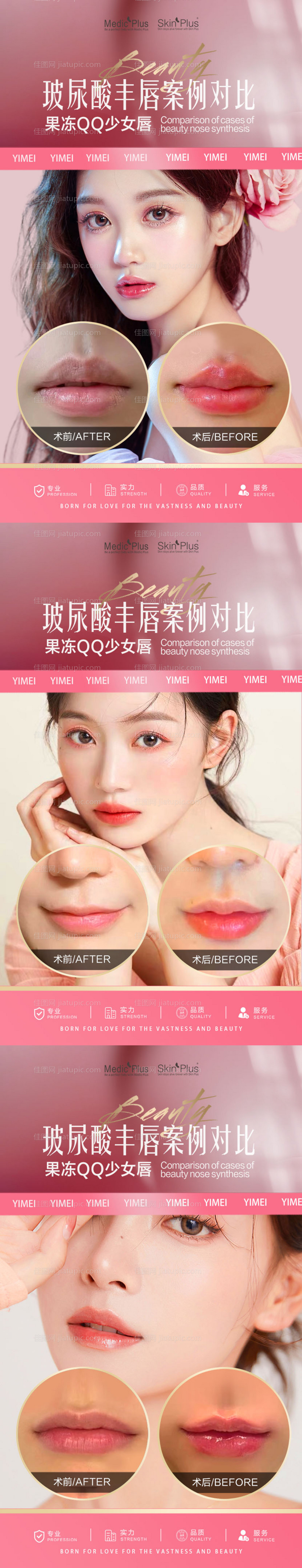 医美玻尿酸丰唇案例系列海报-源文件
