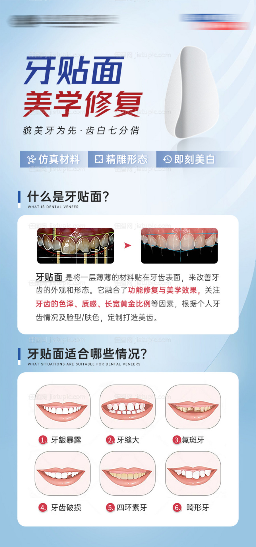 牙贴面美学修复详情页口腔科普海报-源文件
