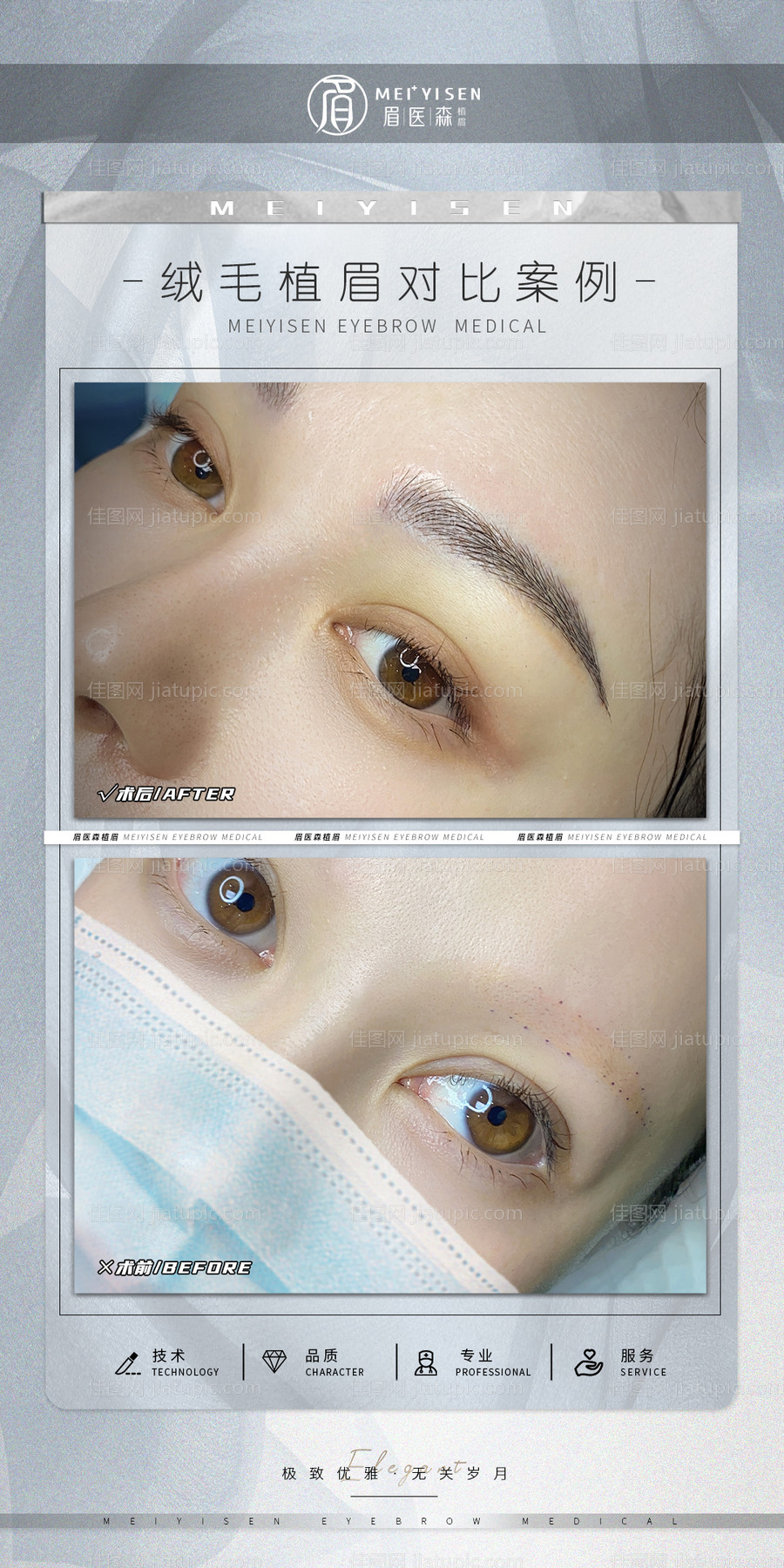 案例对比图海报-源文件