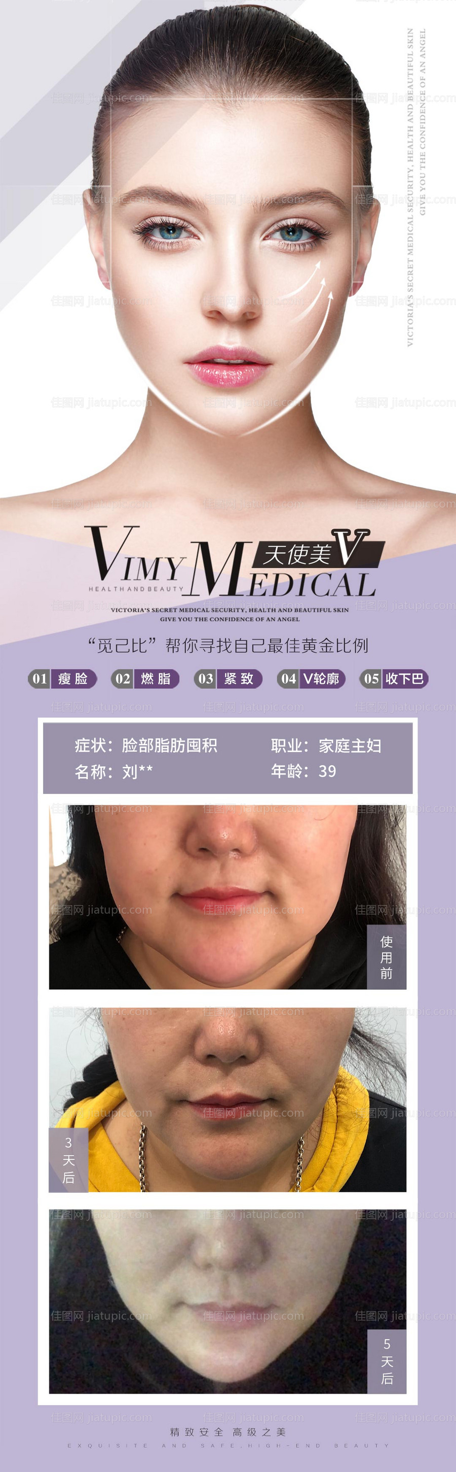 医美海报-源文件