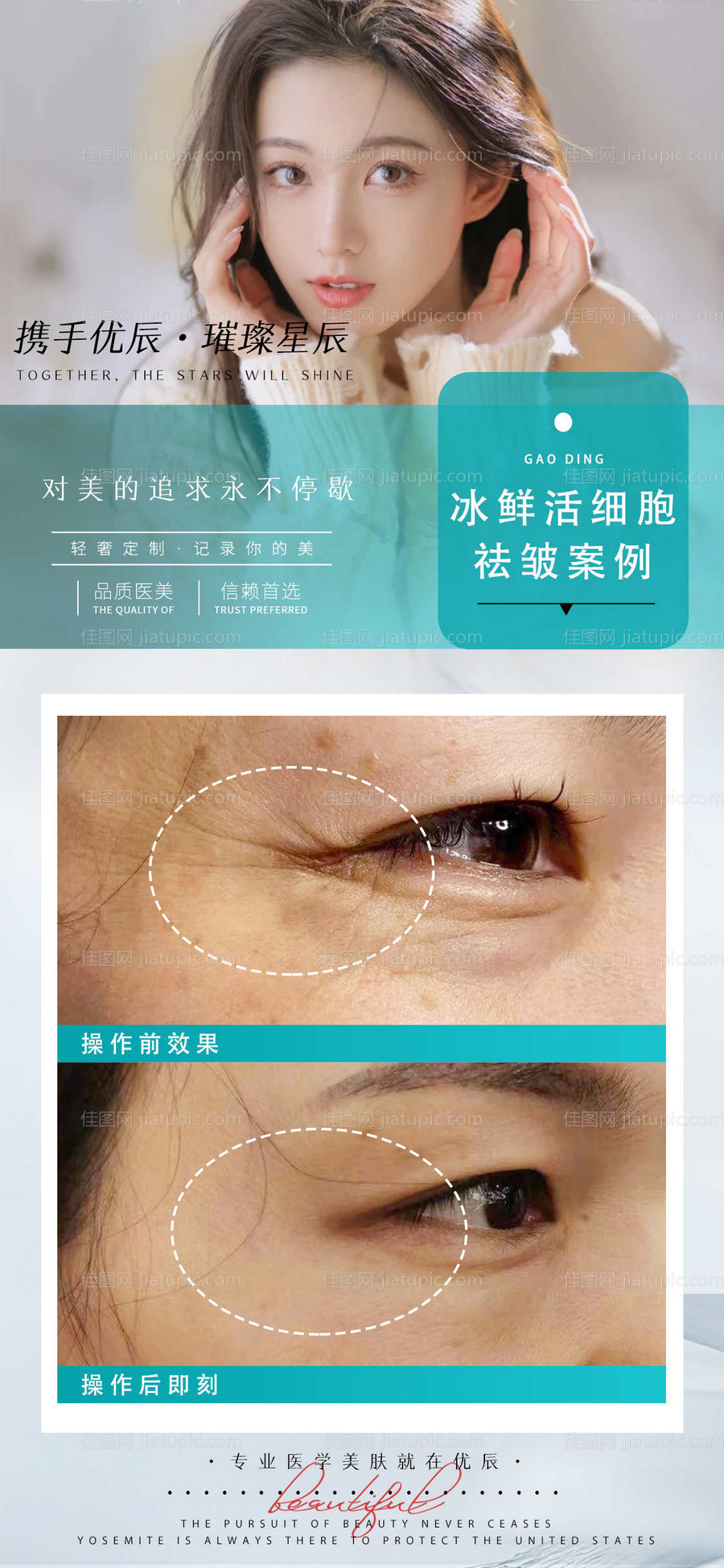 医美案例对比人物海报-源文件