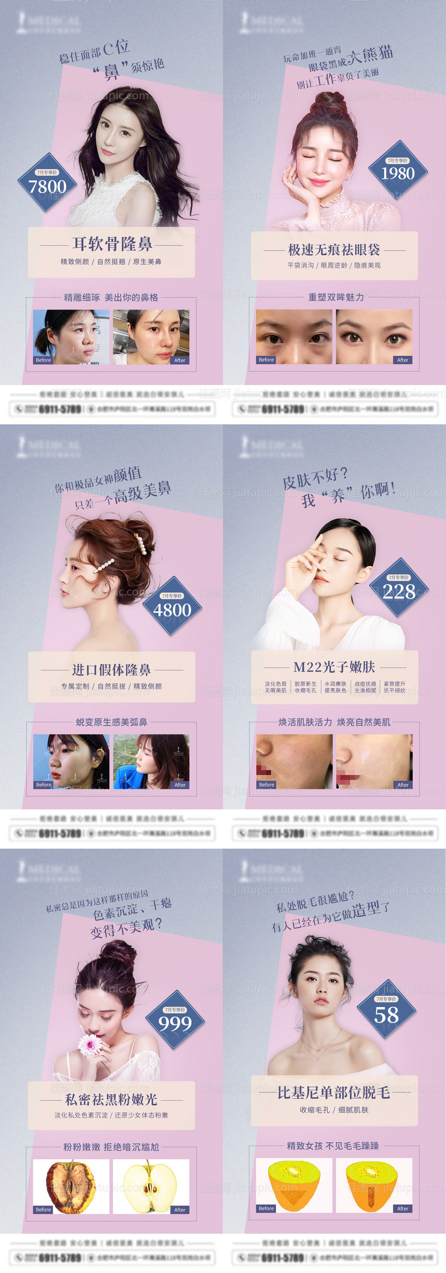 医美系列宣传海报-源文件