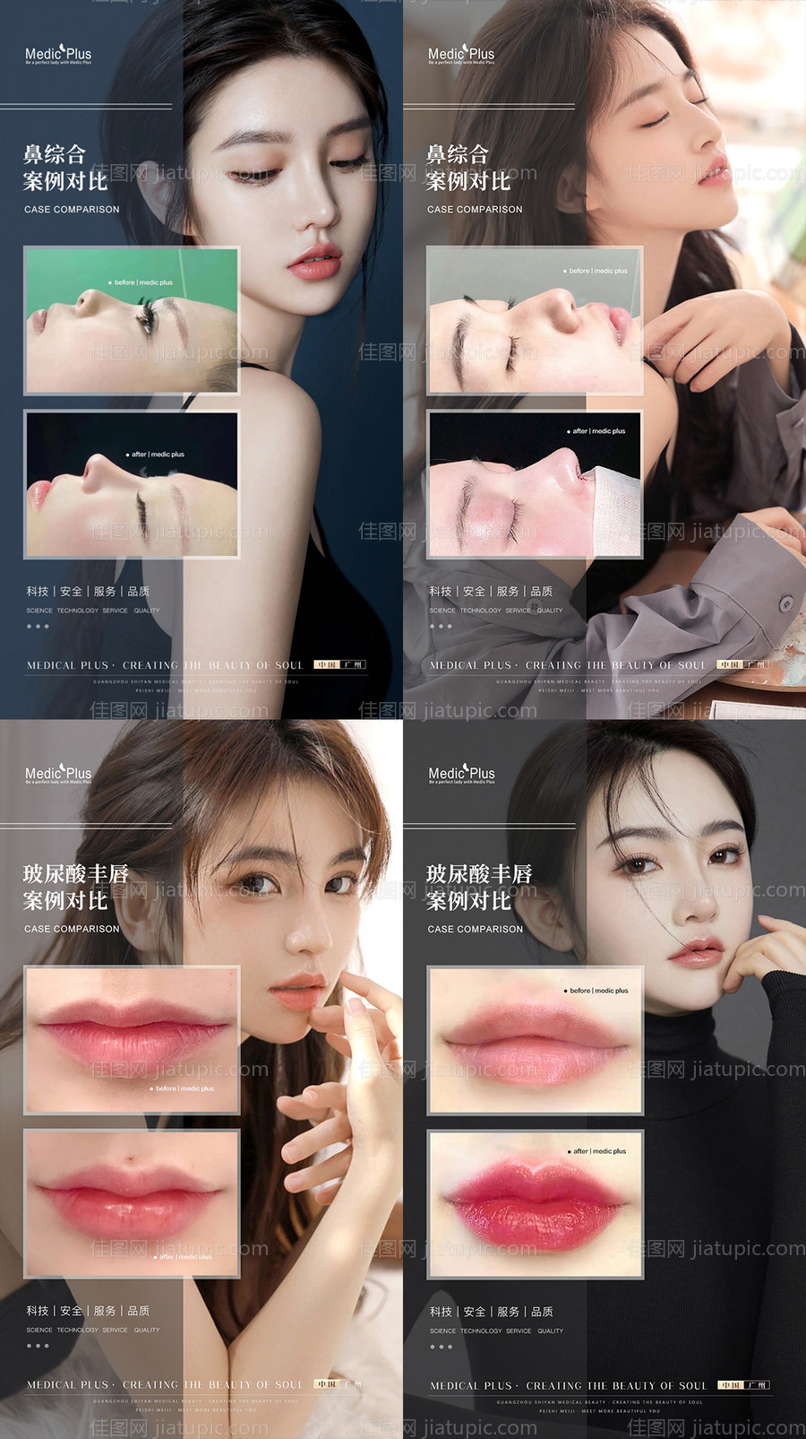 医美案例系列海报-源文件