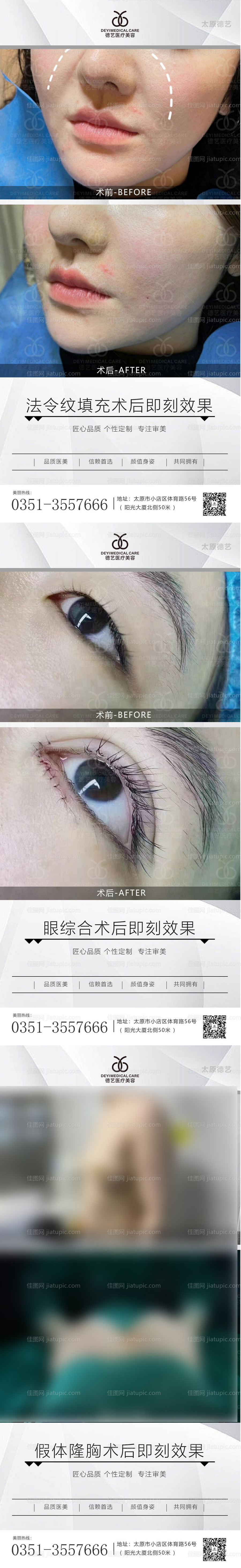 医美案例对比图-源文件