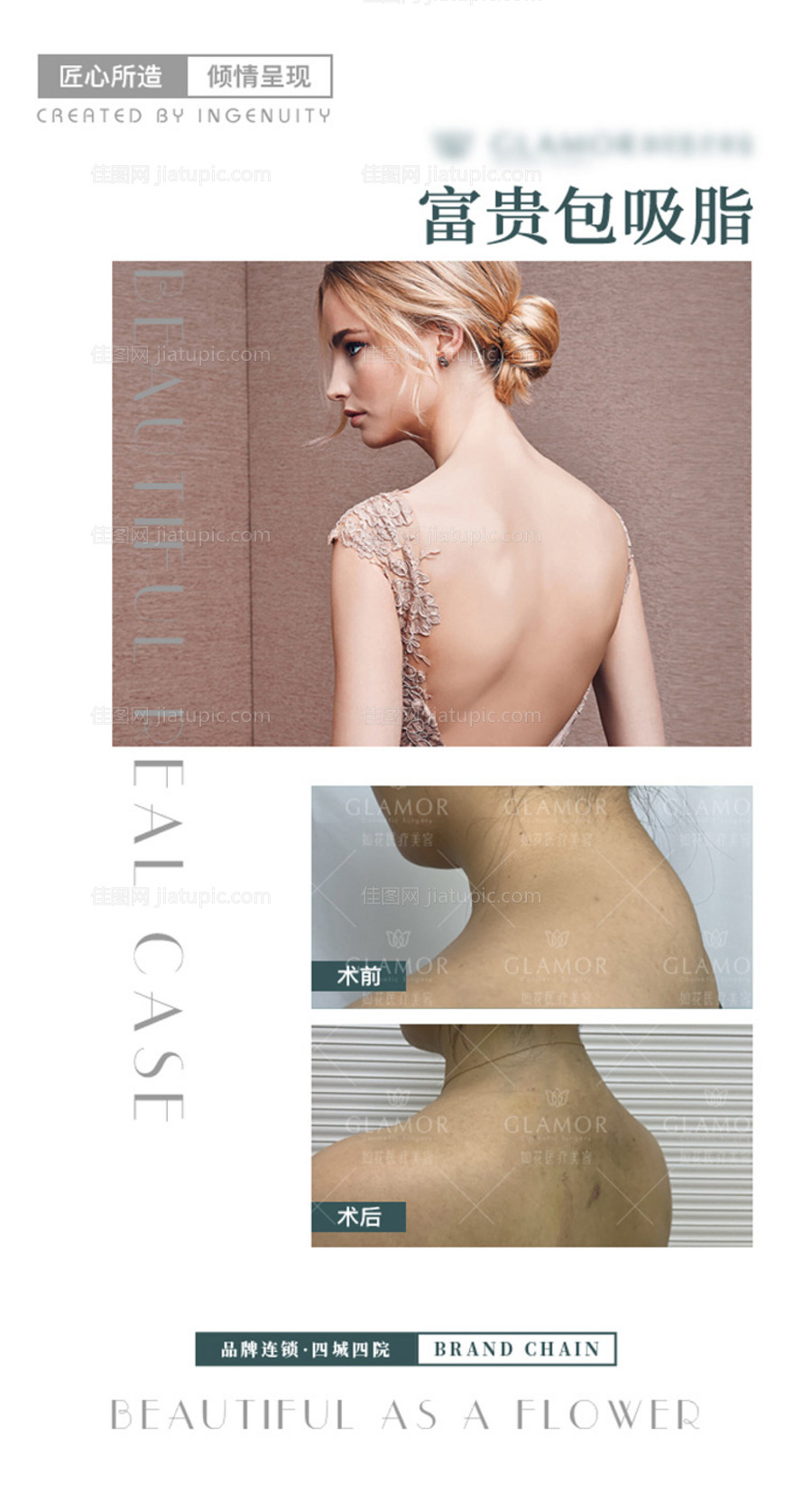 医美案例对比图海报-源文件