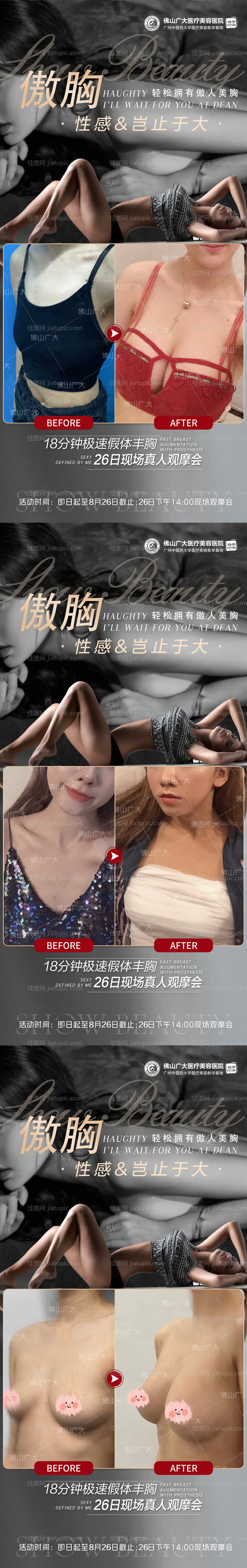 医美隆胸案例活动系列海报-源文件