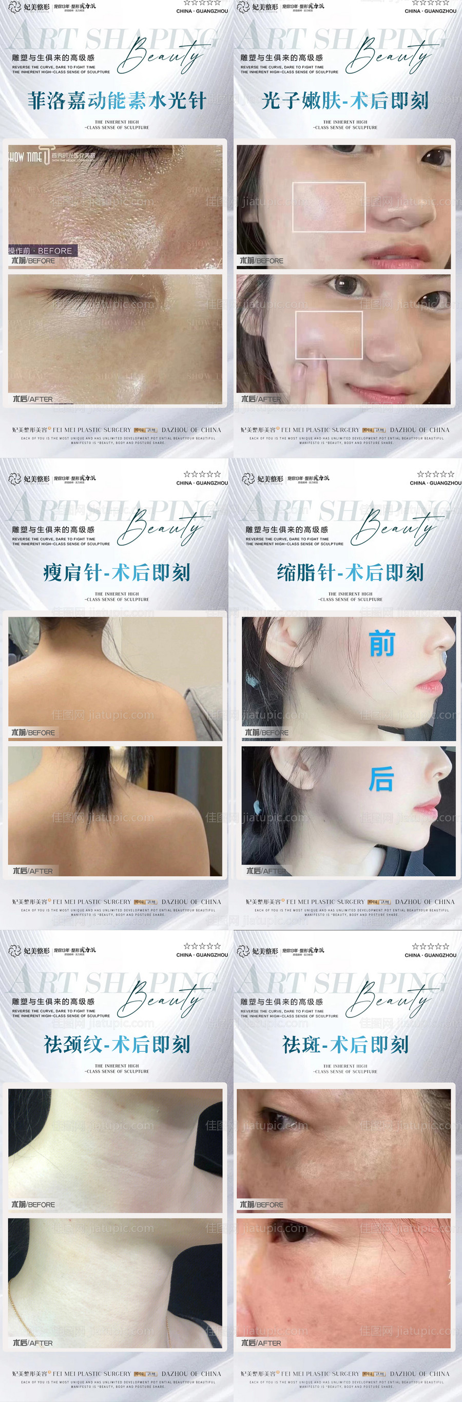 医美皮肤项目案例集-源文件