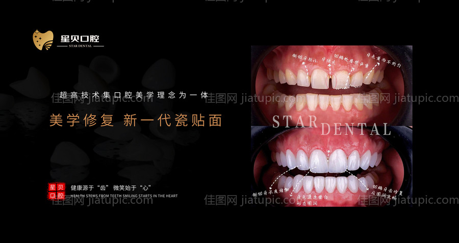 口腔宣传海报-源文件