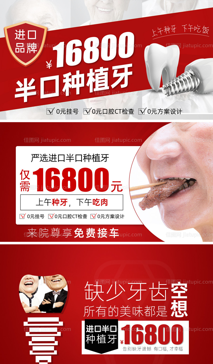 种植牙海报展板-源文件