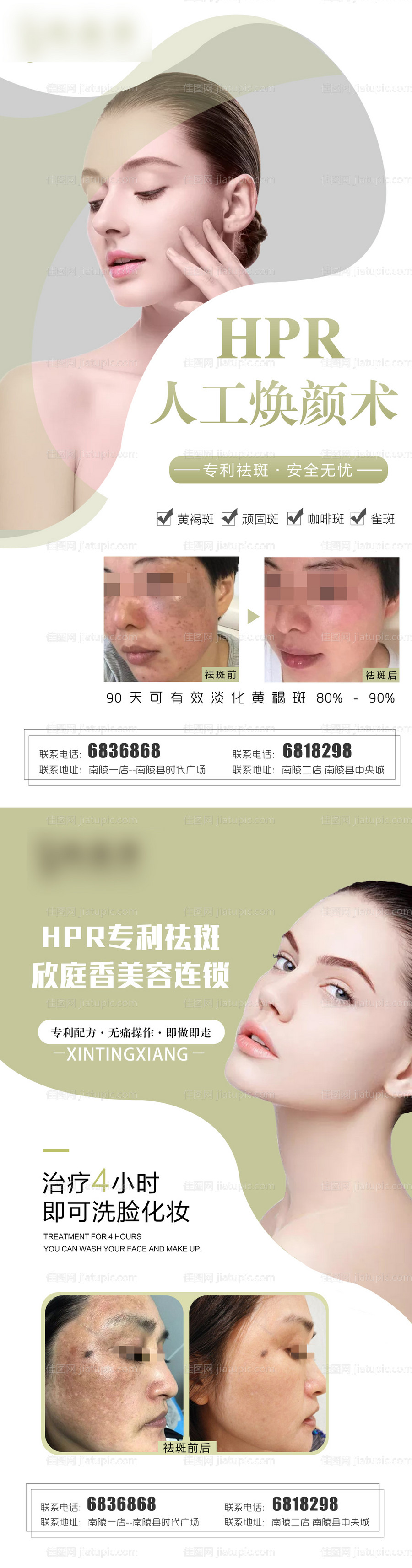 医美美容祛斑案例效果-源文件