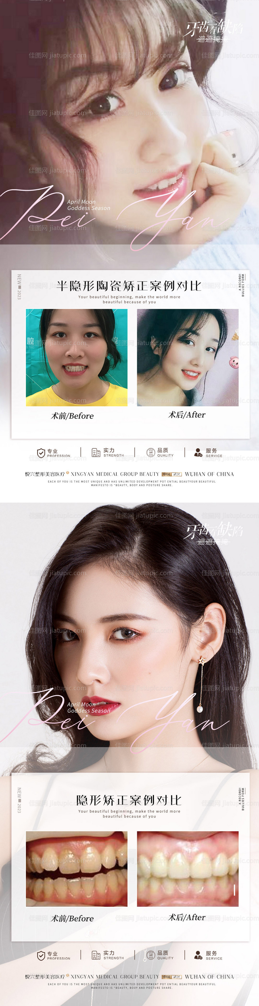 口腔案例长图海报-源文件