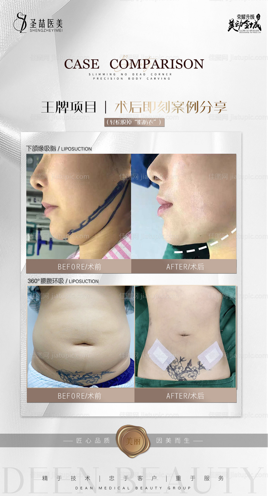 医美整形案例-源文件