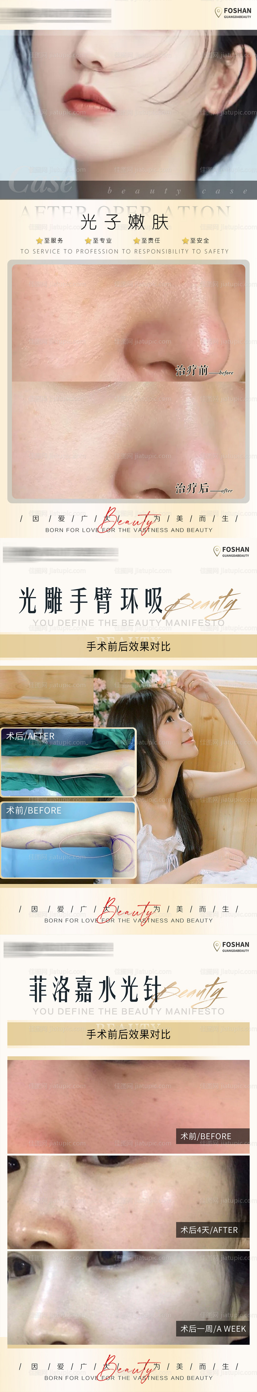 整形真人案例分享集-源文件