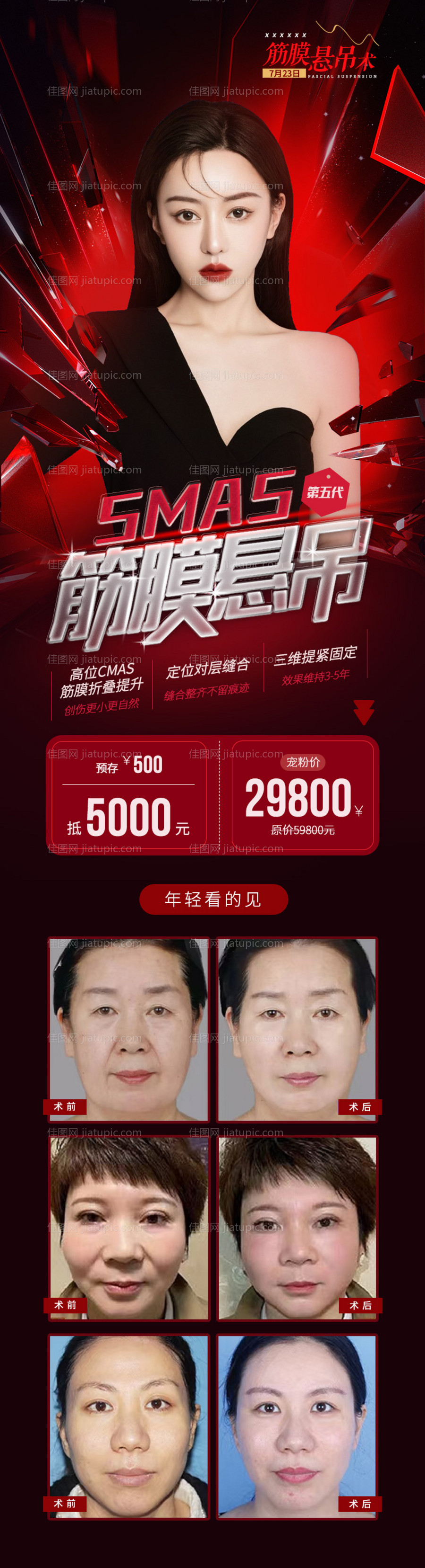 医美筋膜悬吊术海报-源文件