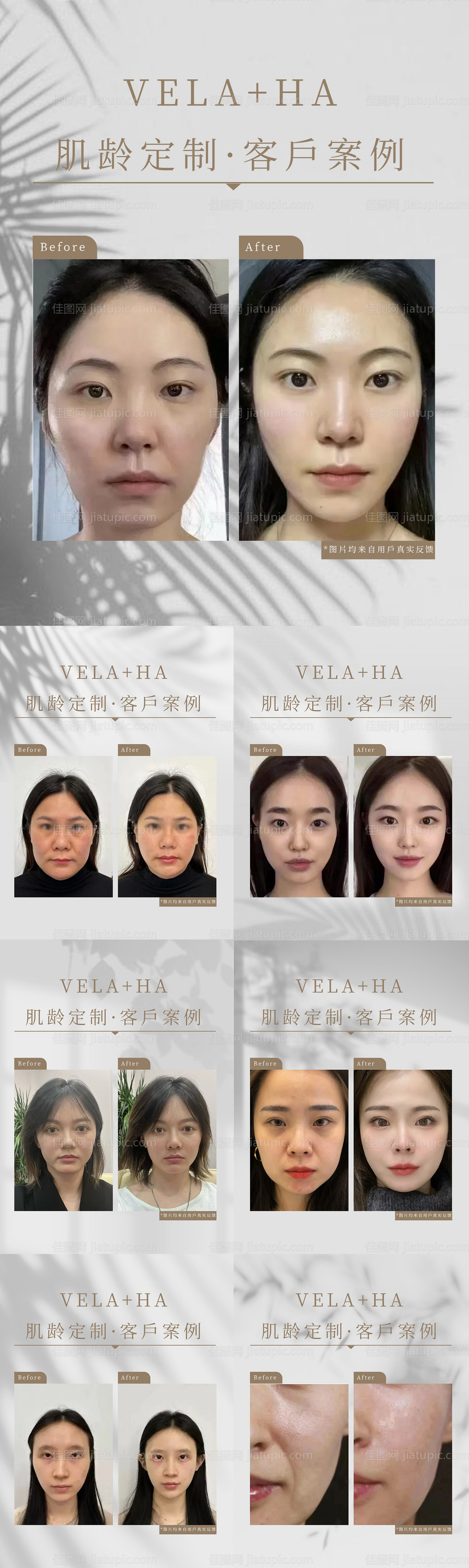 医美抗衰对比图-源文件