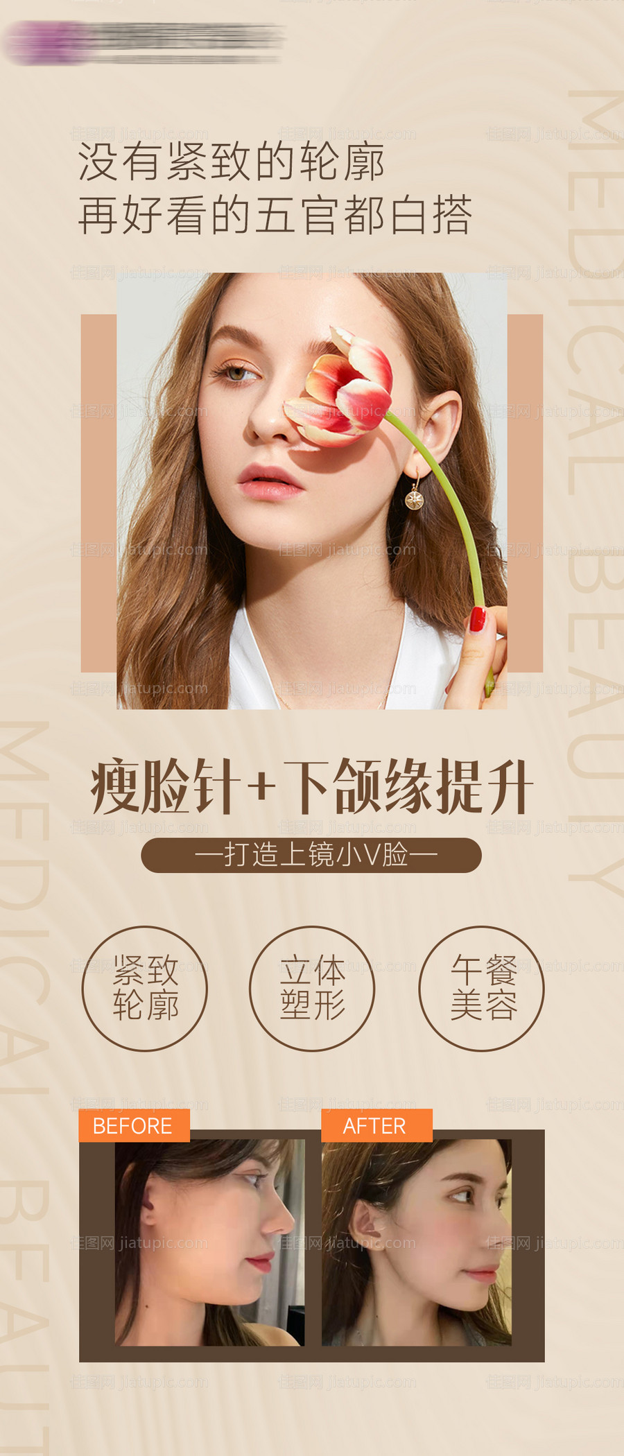 医美瘦脸下颌缘提升海报-源文件