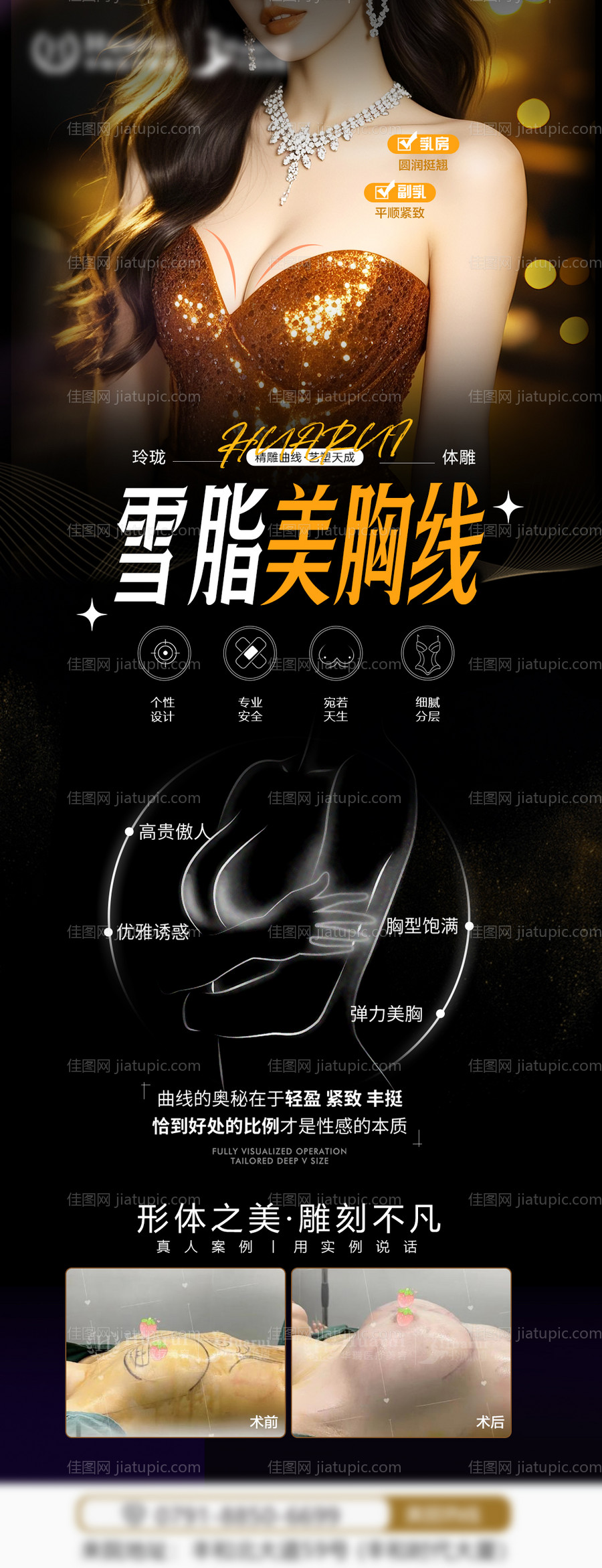 医美胸部体雕宣发海报-源文件