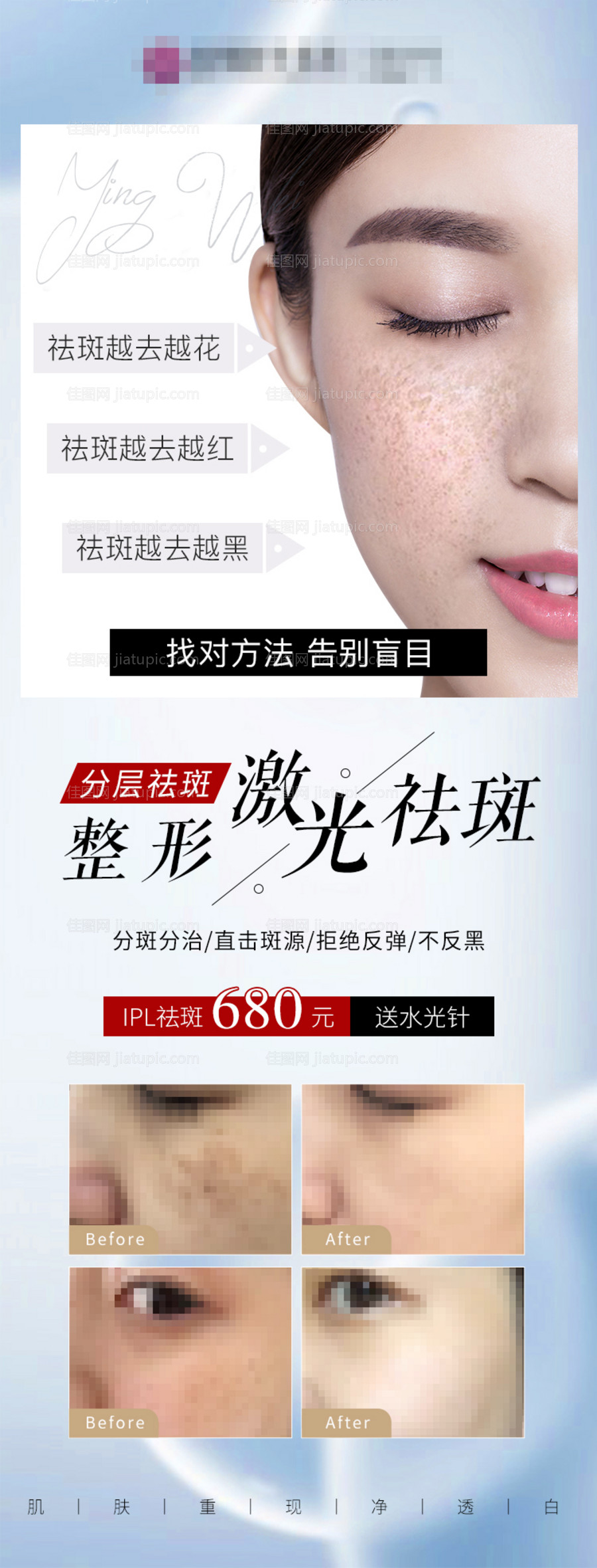 美容祛斑海报-源文件