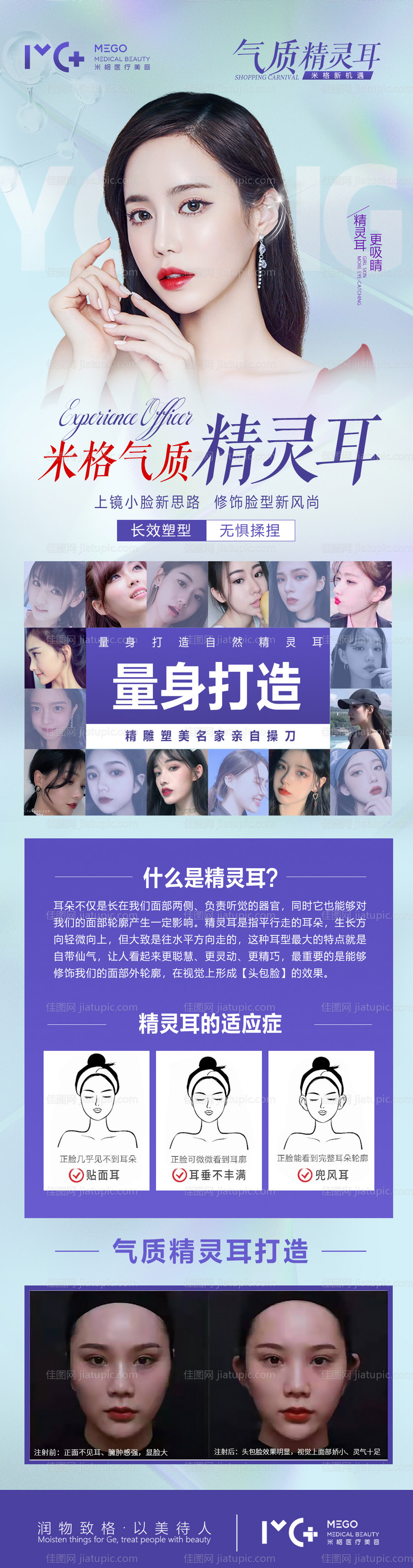 医美项目新品精灵耳海报-源文件