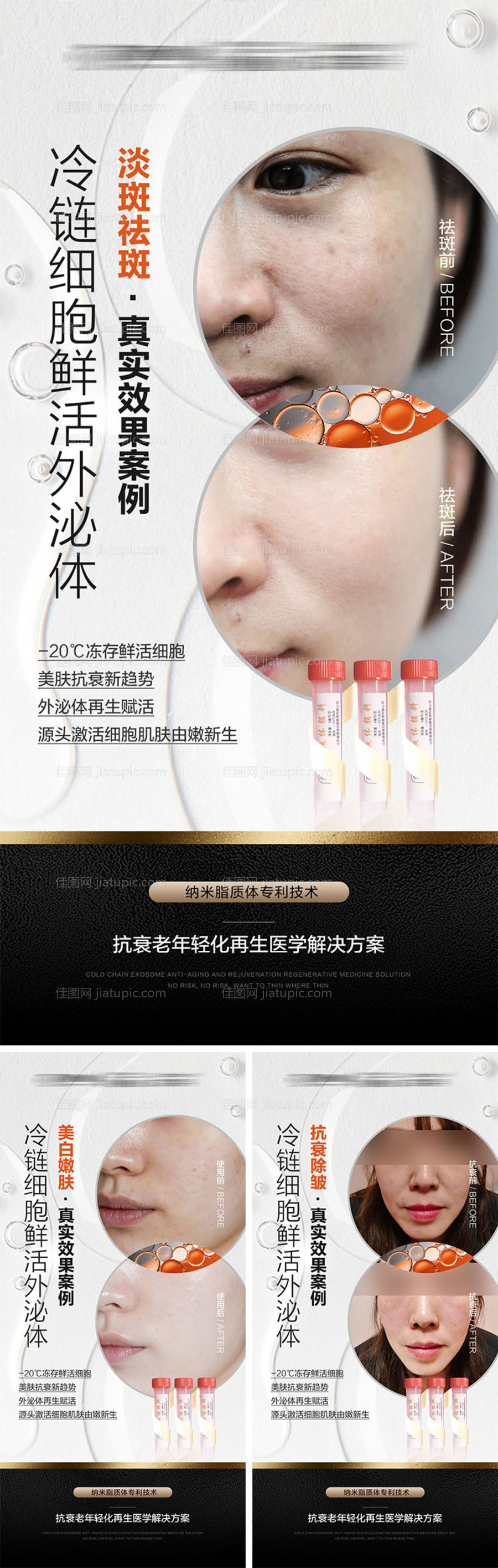 医美外泌体案例宣传海报-源文件