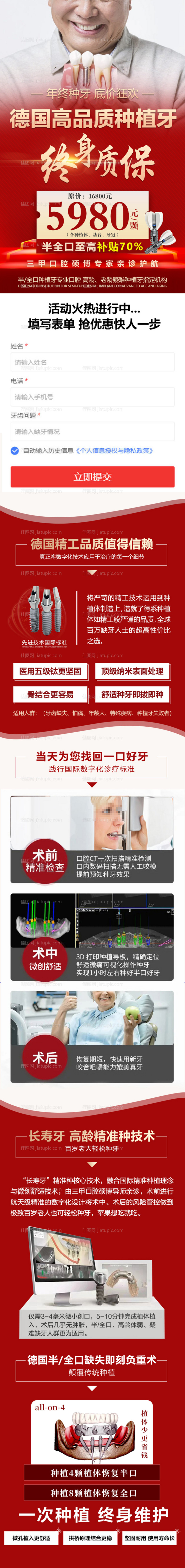 德国高品质种植牙终身质保长图-源文件