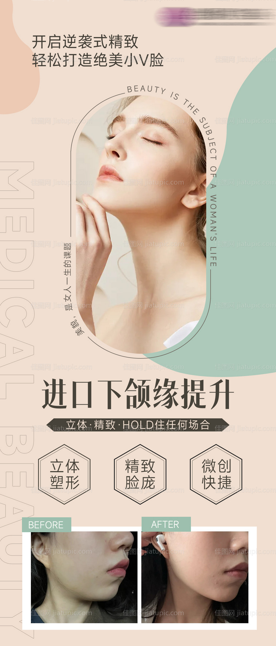医美下颌缘提升海报-源文件