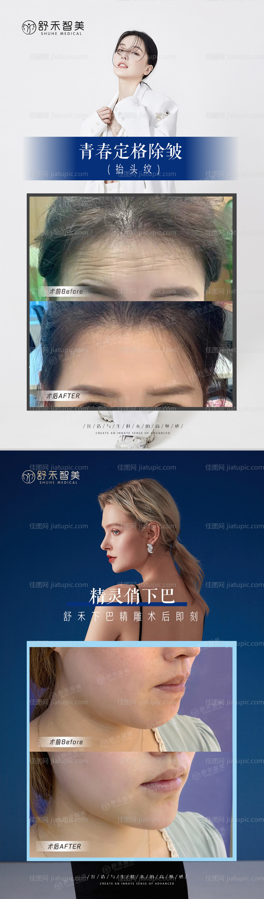 医美活动案例海报-源文件