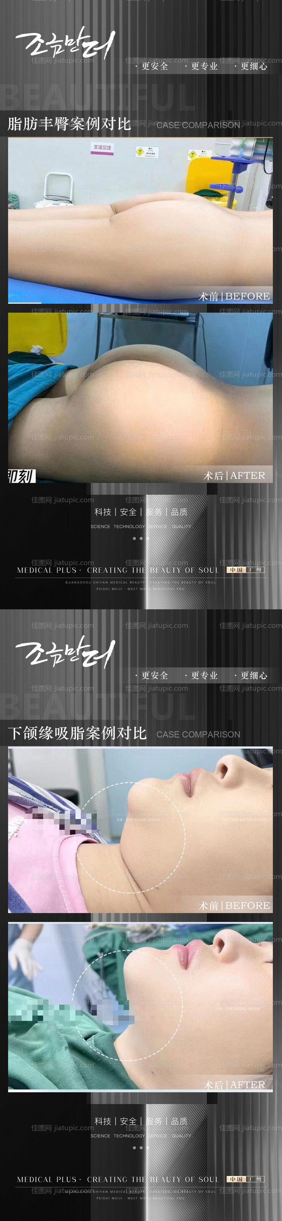 医美案例-源文件