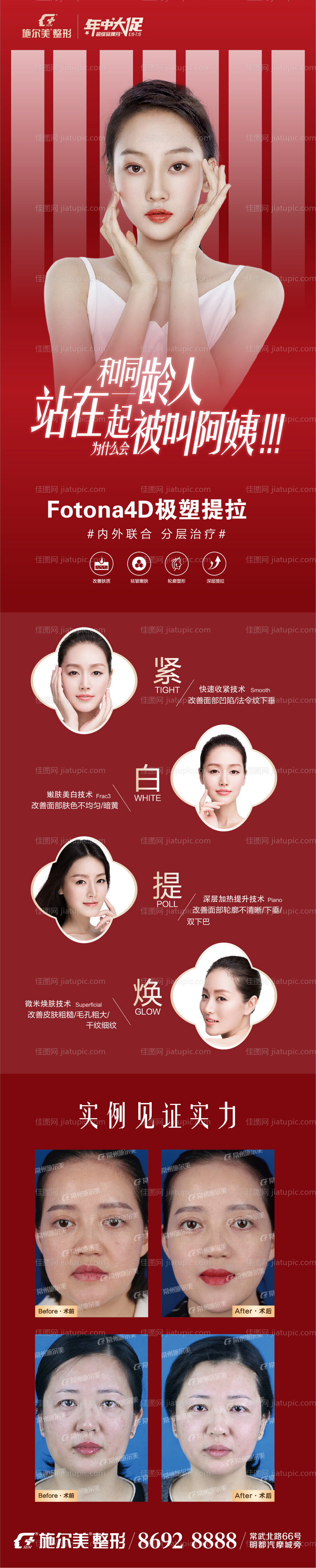 Fotona4D朋友圈-源文件