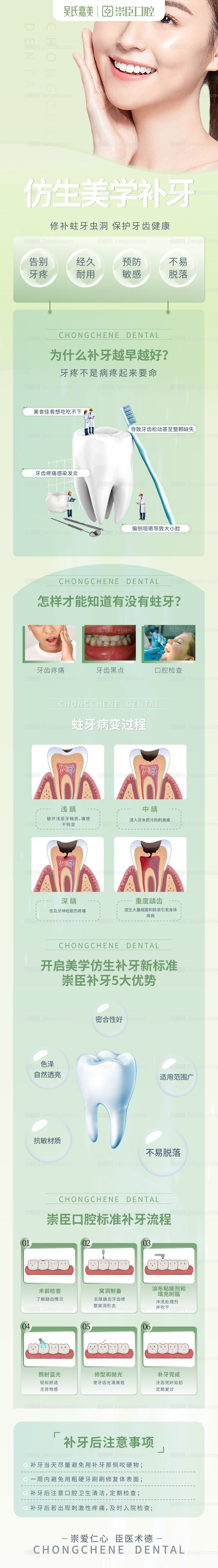仿生美学补牙详情页-源文件