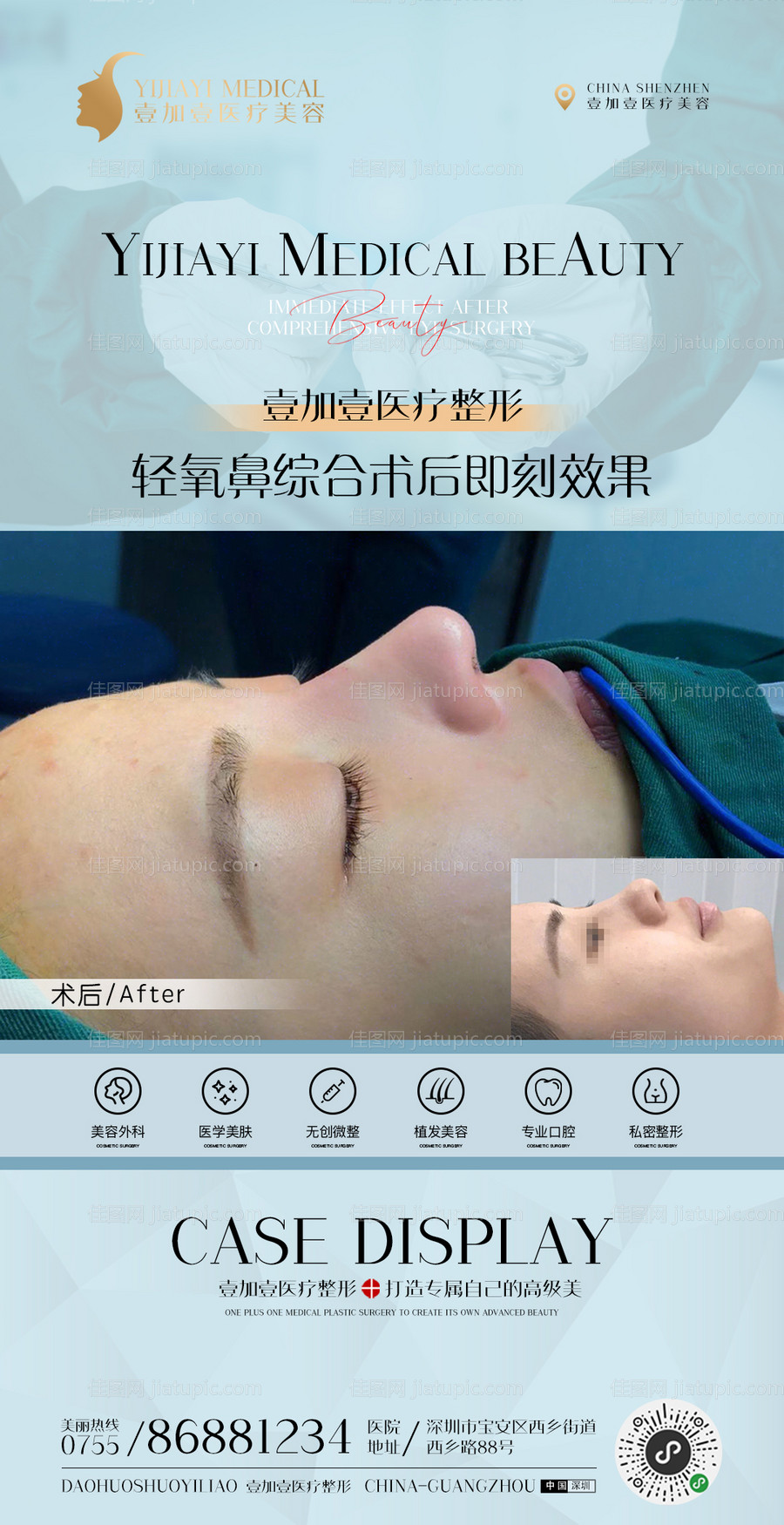 医美整形案例-源文件