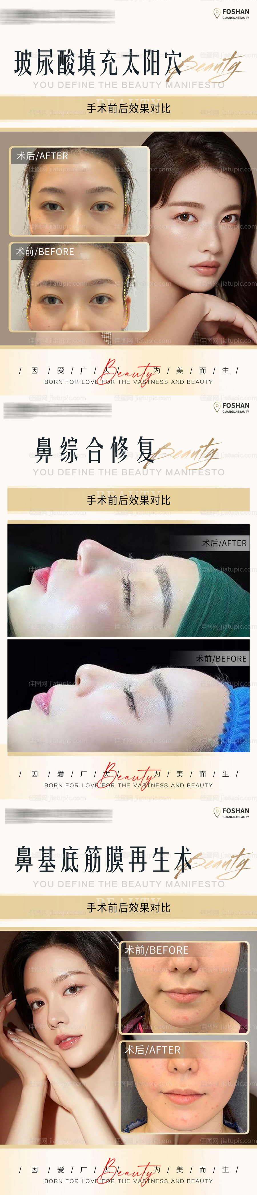 医美真人案例对比-源文件