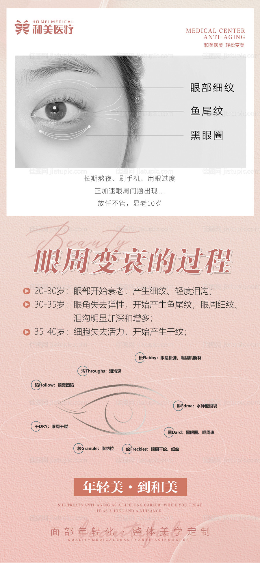 眼周衰老过程海报-源文件