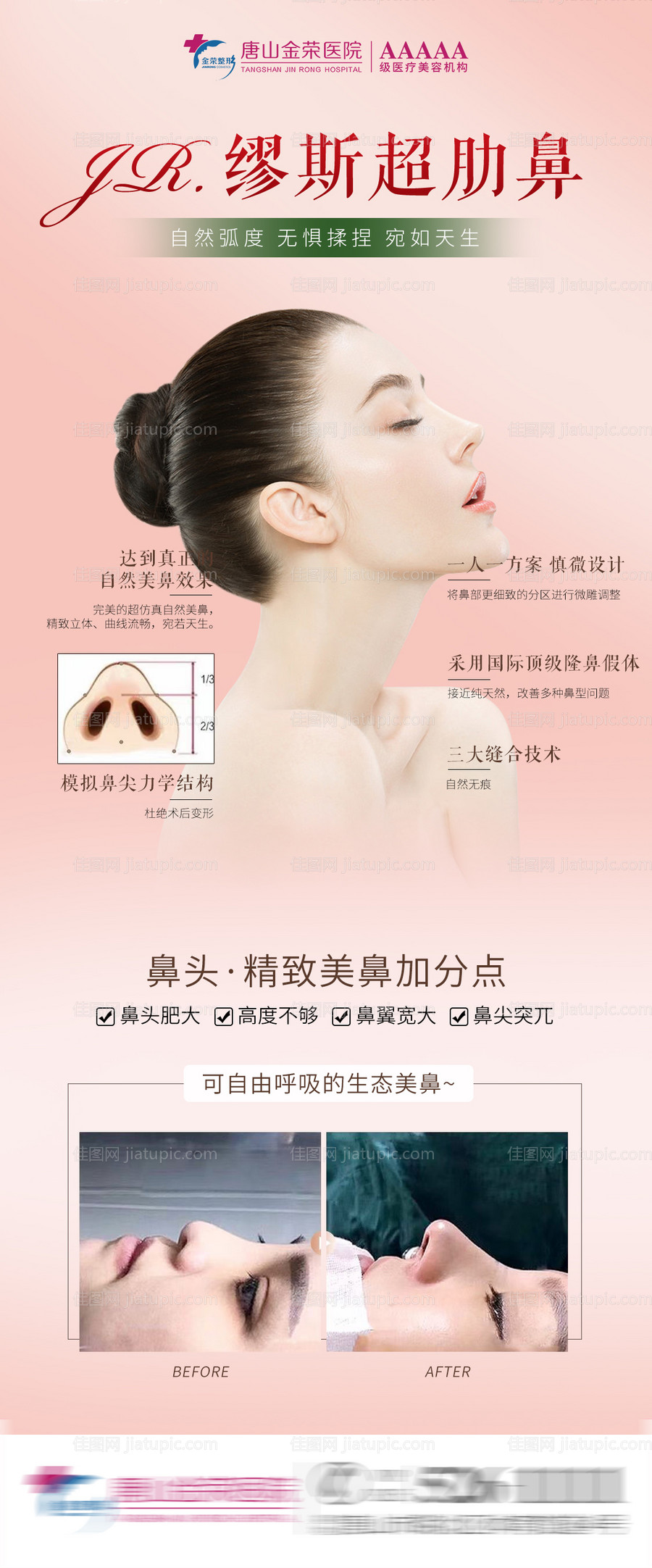 医美缪斯鼻假体海报-源文件