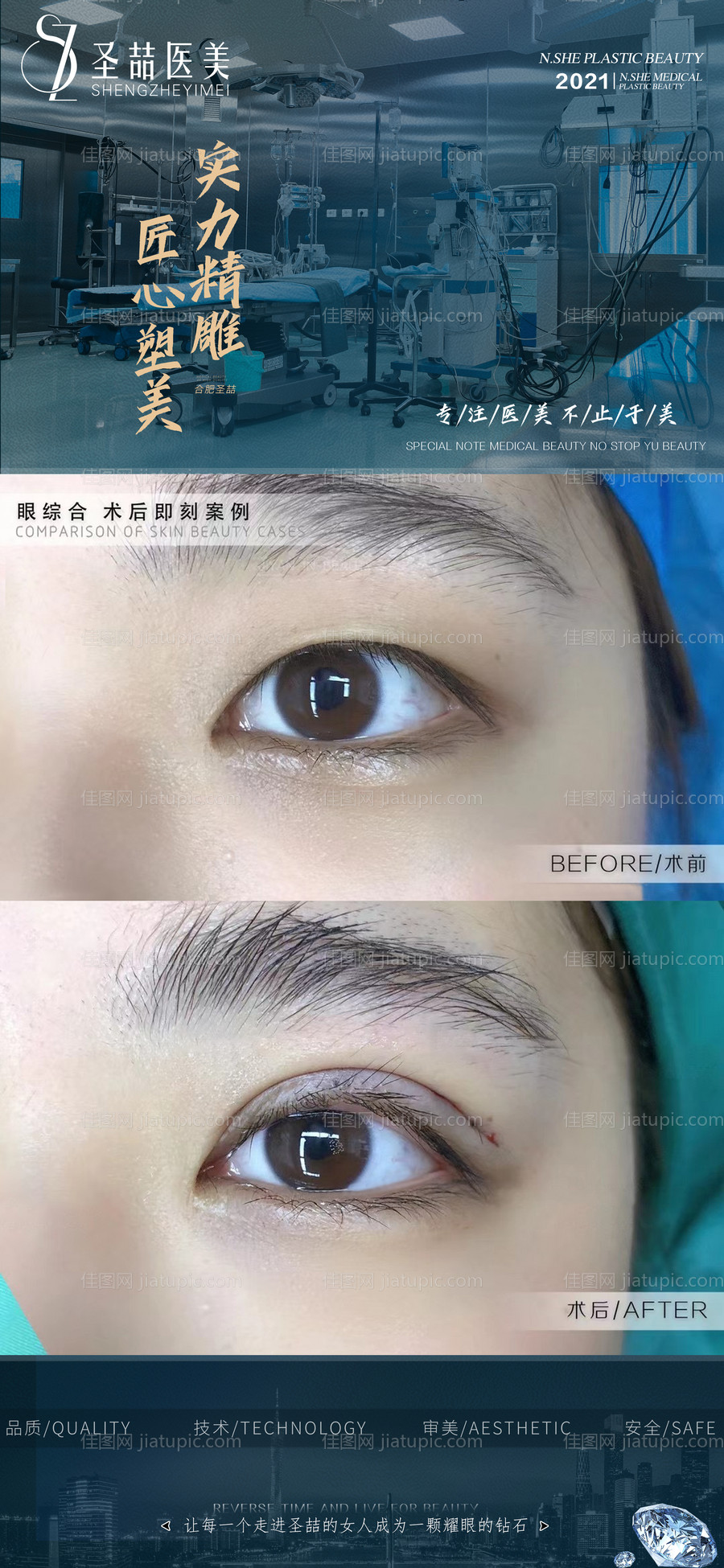 医美整形案例海报-源文件