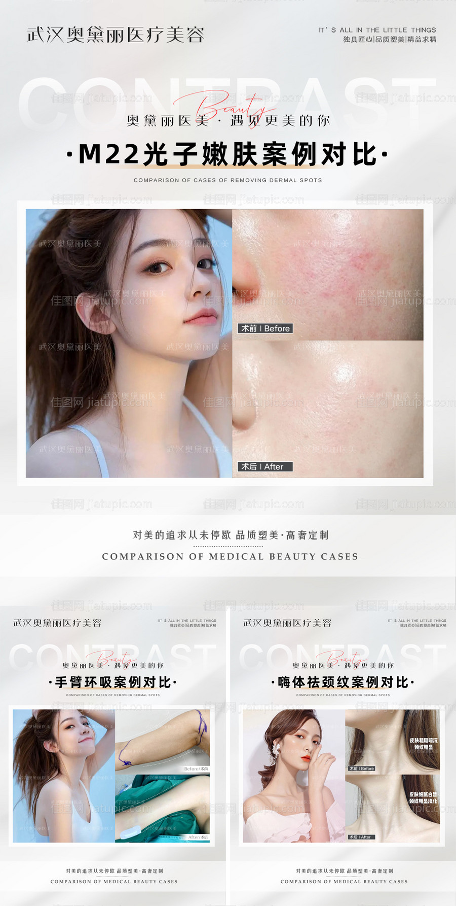 医美整形案例对比-源文件