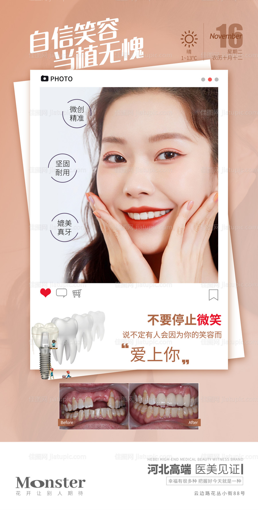 医美口腔种植牙海报-源文件