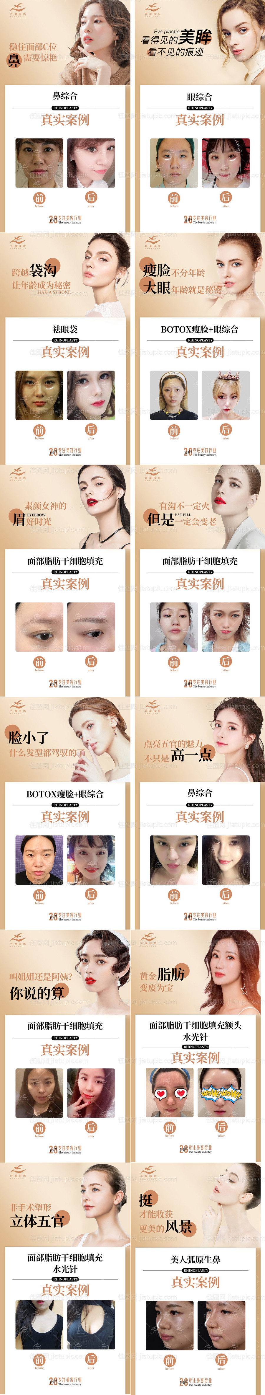 医美案例系列12个-源文件