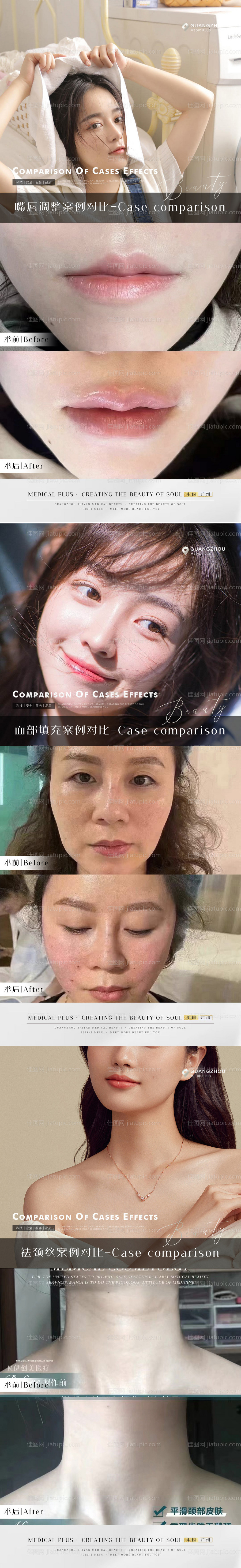 整形真人案例分享集系列海报-源文件