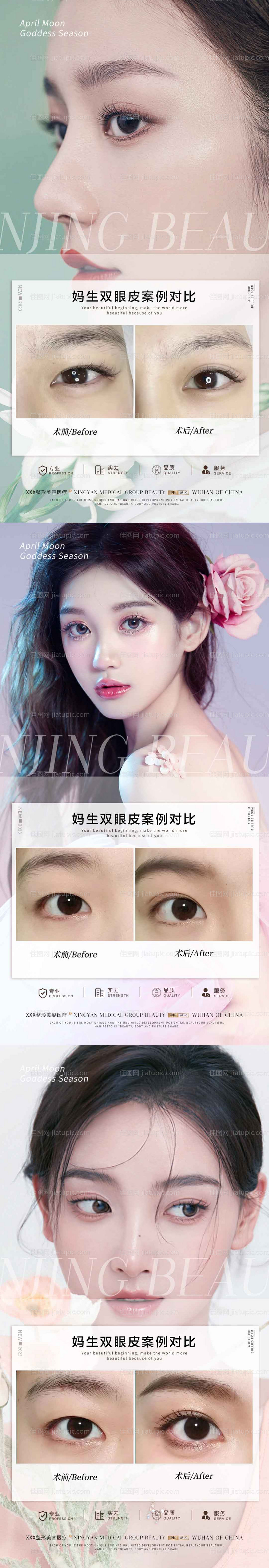 医美眼睛整形案例海报-源文件