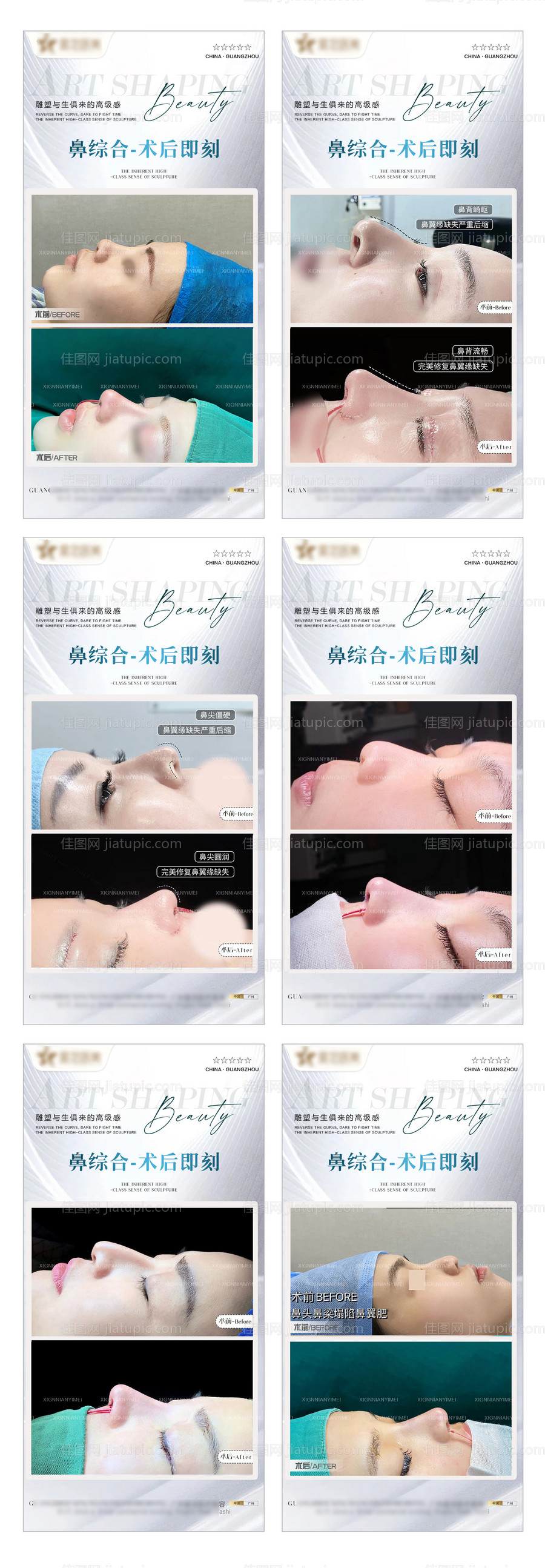 医美鼻综合整形案例海报-源文件