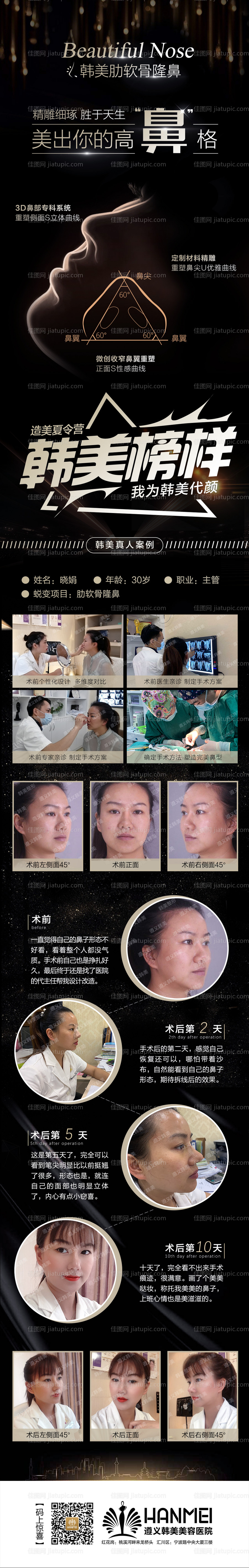 医美整形软骨隆鼻案例对比长图专题设计-源文件