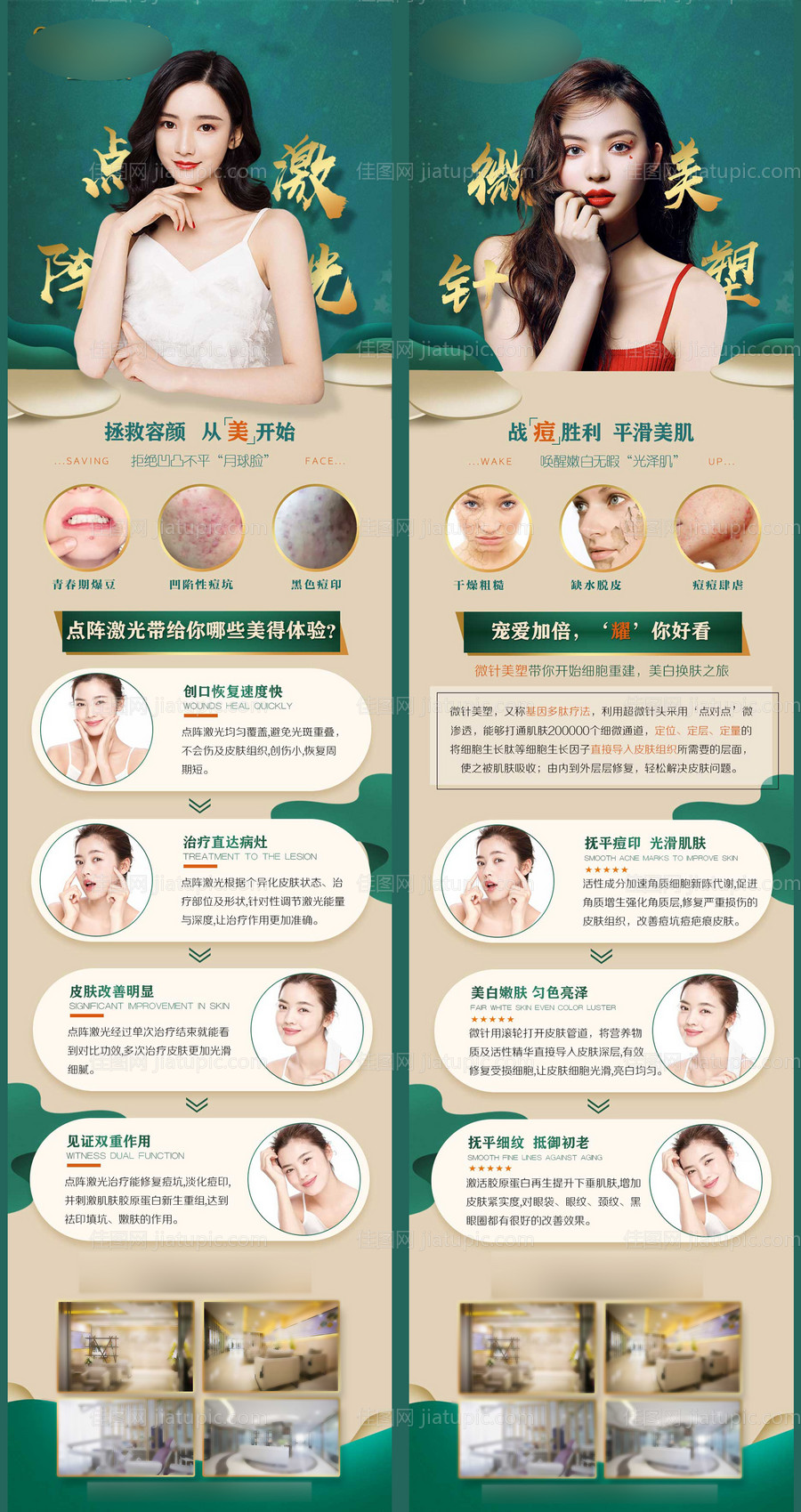 医美祛痘印点阵激光微针美塑长图-源文件