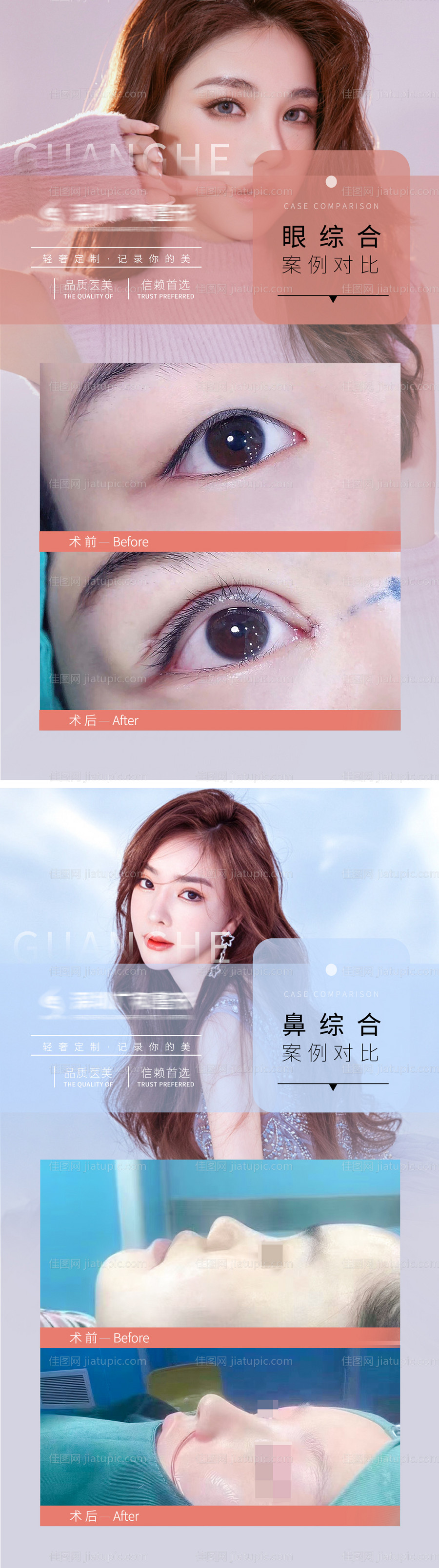 医美案例对比图海报-源文件