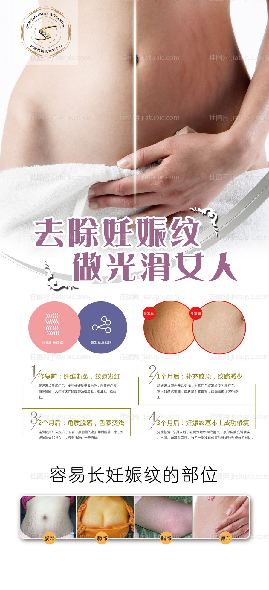 妊娠纹展架-源文件