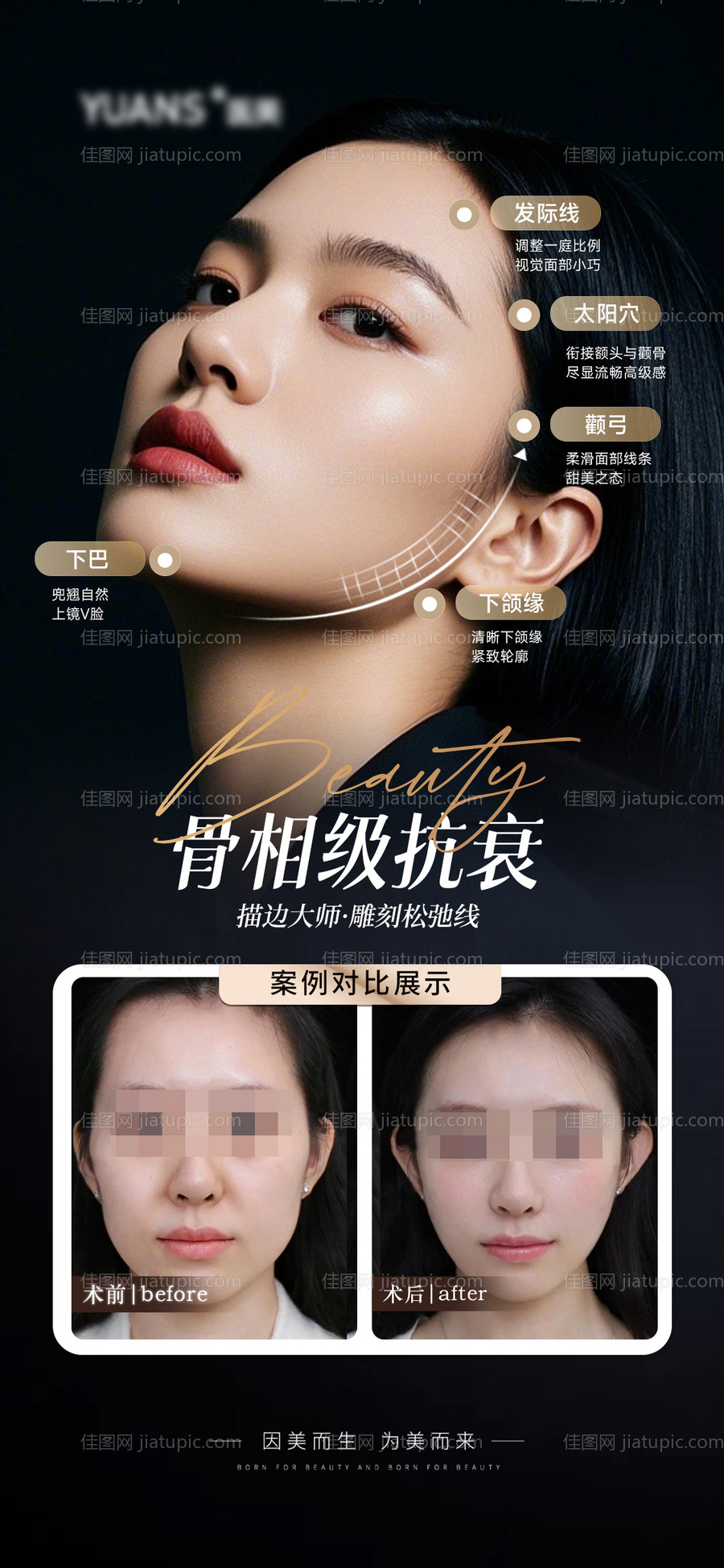 医美轮廓案例海报-源文件