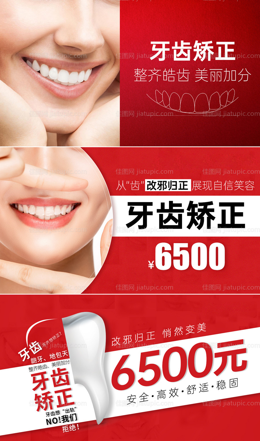 牙齿矫正入口banner图-源文件