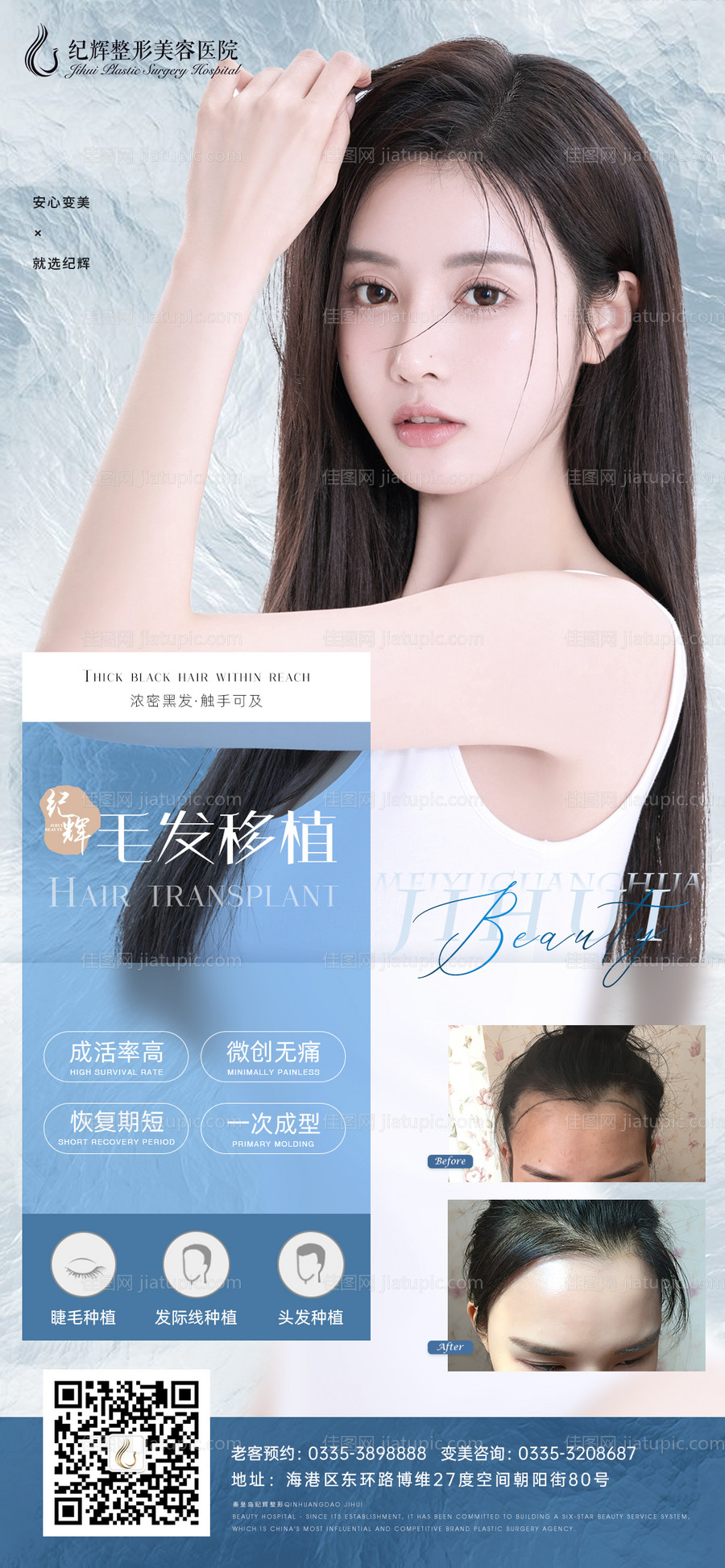 医美整形植发海报-源文件